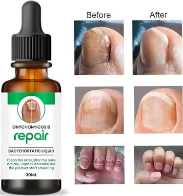 7 days Nail Treatment,Nail Serum & Cuticle Care Oil (Pack of 2)